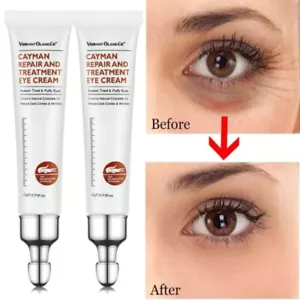 2PCS Collagen Firming Eye Cream Dark Circles, Wrinkles, Fat Granule, Anti-aging - Picture 1 of 14