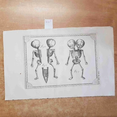 INCISIONE STAMPA '800 anatomia umana scheletro OTTOCENTO 37 X 23,5 cm - Immagine 1 di 2