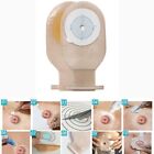 Body Care Colostomy Bags One-piece Open Clip Drainable Colostomy Bags  Ostomy
