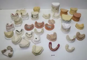 Diversi modelli odontoiatrici da lavoro, esercizi + schiuma # 3443 - Foto 1 di 1