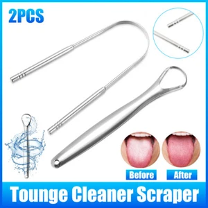 2pcs Stainless Steel Tongue Scraper Oral Tools Tongue Coating Cleaner Device - Picture 1 of 12