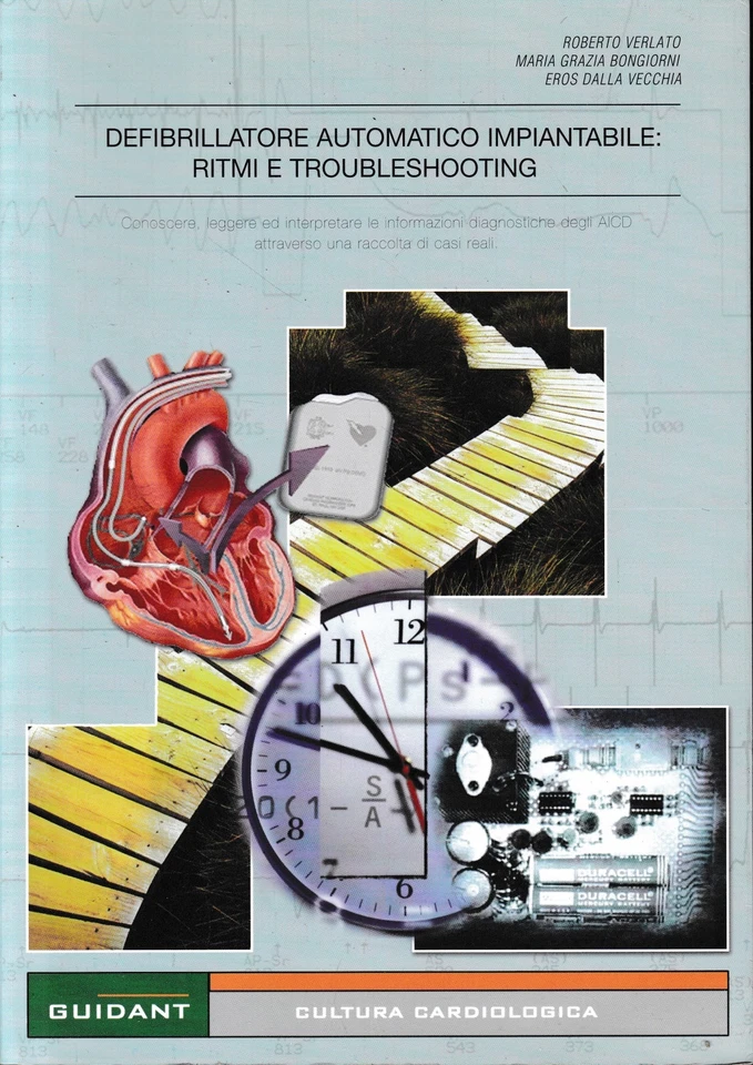 Defibrillatore automatico impiantabile: Ritmi e Troubleshooting - Immagine 1 di 1