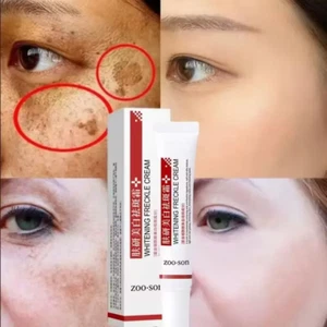 Effective Whitening Freckle Cream Remove Dark Spot Cream Removal Melanin Melasma - Picture 1 of 2