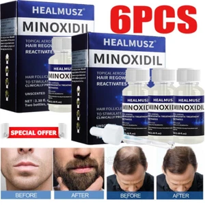 6X Minoxidil 5 % Serum Haarwuchslösung für Männer & Frauen 50 ml 6 Monatsvorrat - Picture 1 of 18