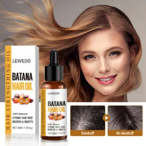Batana Öl Serum für Haarwachstum Haarpflege,Bio-Batana-Öl Haarausfall Behandlung - Bild 1 von 15