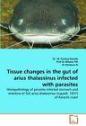 Tissue changes in the gut of arius thalassinus infected with parasites        <|