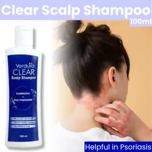 Shampoo Anti Scaling Capelluto 100ml - Tratta Psoriasi, Dermatite Seborroica - Foto 1 di 6