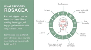 Rosacea Cream Lotion Serum for Face Skin | Soothes & Reduces Rosacea Redness ... - Picture 1 of 12