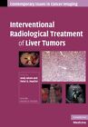 Interventional Radiological Treatment Of Liver Tumors (Contempor