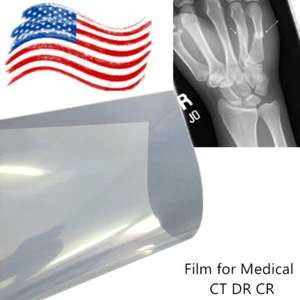 Inkjet and Laser Printers Printing Film for Medical CT DR CR - Picture 1 of 10