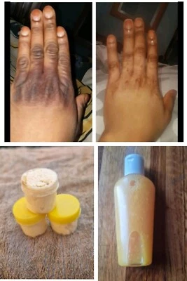 HOME MADE DARK KNUCKLES, FEET, KNEE PERFECTOR SERUM 80ml And Maintenance Cream 20ml Set