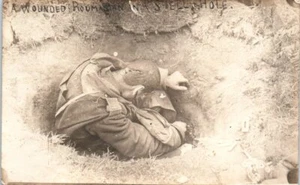 WWI RPPC Real Photo Postcard Wounded Romanian Soldier Shell Hole Military WW1 - Picture 1 of 2