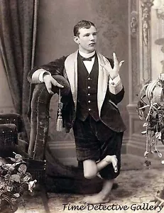 Circus Side Show Freak with Claw Hands - Historic Photo Print - Picture 1 of 1