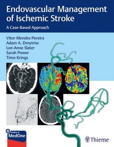 Endovascular Management of Ischemic Stroke : A Case-Based Approach, Paperback... - Bild 1 von 1
