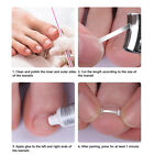 Ingrown Toe Nail Correction Treatment Elastic Patch Sticker Straightening Clip