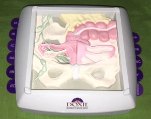 OVARIAN CANCER 3-D MODEL Female Uterus Vagina Cervix Anatomical Teaching OB GYN - Picture 1 of 6