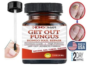Nail Fungus Antifungal Home For Toe and Finger Nails Fungal Support - Picture 1 of 9