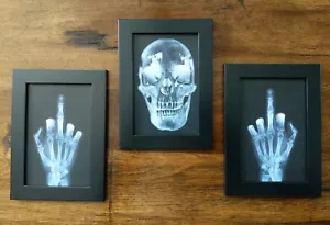 Human Skull Middle Finger Xray Prints Framed Set 4x6" Home Goth Oddities Decor - Picture 1 of 2