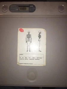Fuji IP Cassette Type C 14x17in - Picture 1 of 2