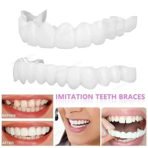 Snap On Upper&Bottom Set Falsche Zähne Dental Veneers Zahnersatz Zahnabdeckung Silikon - Bild 1 von 16