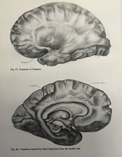 Set of 2 Vintage Ephemera Illustrated Diagram Brain Medical Anatomy Office Decor