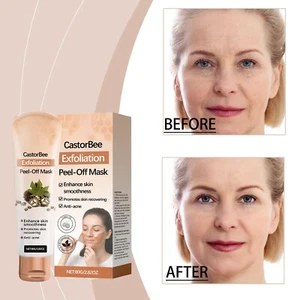 80ml Herbal Anti Peel Off Tear Suitable For All Skin Types Deep - Picture 1 of 15