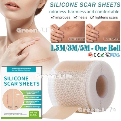 Silicone Scar Sheets & Tape Roll 1.5/3/5M | Scar Removal, Keloid, Acne, Marks - Image 1 of 4