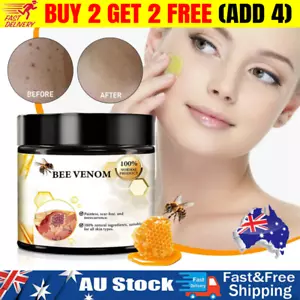 Bee Venom Skin Tag Removal Treatment Cream For Body Care Mole Corn Skin Wart - Picture 1 of 7