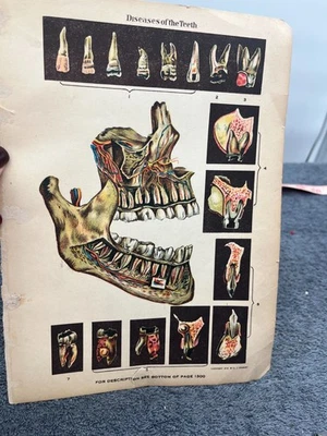 vintage medicine litho print 1916 stanley teeth skull diseases victorian medical - Image 1 of 4