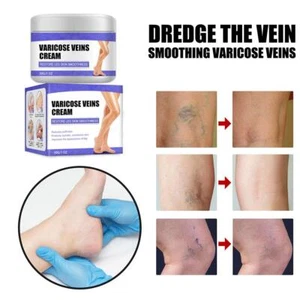 1*Treatment Legs Varicose Veins Cream VeinCare Fading Cream Herbal Ointment New - Picture 1 of 9