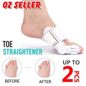 Bunion Corrector Hammer Toe Splint Straightener Orthopedic Brace Valgus Hallux - Picture 1 of 7