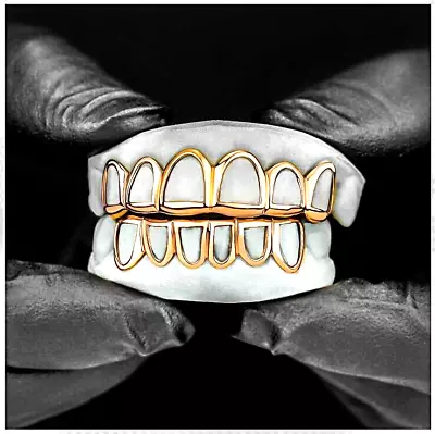 Custom Fit Open Face 14K Gold Plated Mouth Teeth Grills Grillz Upper Lower Set - Image 1 of 2