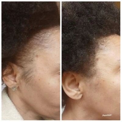 Organic  Hair Growth Oil Serum DHT-Alopecia-Thinning Hair-Balding (60ml)  - Image 1 of 4