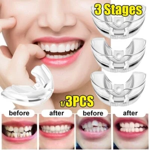 Corrector dental dental de 3 etapas abrazaderas retenedor dental herramienta de alineación - Imagen 1 de 13