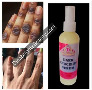 Dark Knuckles/ Knee/Elbow Remover serum - Picture 1 of 1