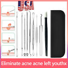 Blackhead removal needle double-ended acne needle to pick acne and squeeze acne