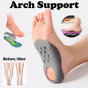 Foot Orthotic Corrective Arch Support Insole Pronation Supination O/X Type Legs - Picture 1 of 4