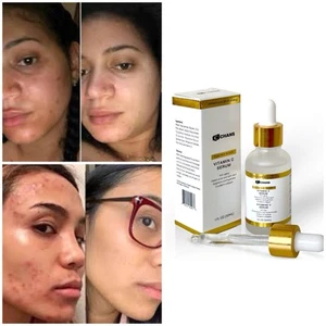 4 In 1 Serum, Vitamin C, Hyaluronic, Retinol Niacinamide. Korean Anti-aging,Glow - Picture 1 of 10