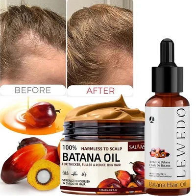 Batana Oil Conditioner for Hair Growth, Anti Hair Loss Serum Spray For Men Women - image 1 of 4