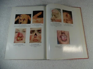 Farbatlas der Dermatologie Deutschland 1. Auflage Frieboes/Schonfeld 1966 1-4I - Bild 1 von 12
