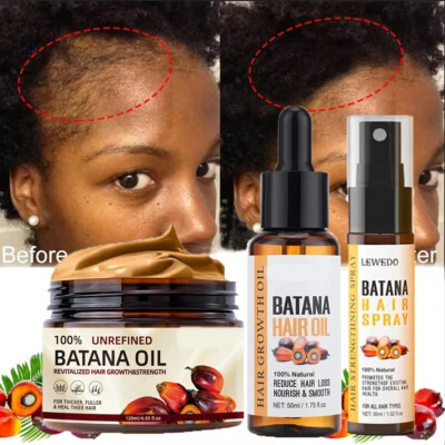 Natural Batana Oil Serum For Hair Growth Healthier Thicker Fuller Anti-Hair Loss - image 1 of 4