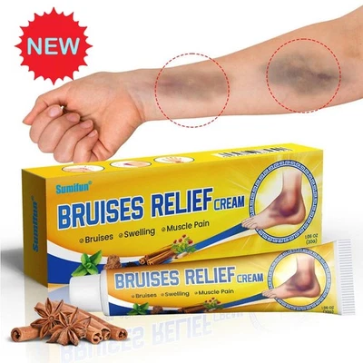 Bruises Relief Cream RelievesPain and Removes Blood Stasis H O T - Image 1 of 4