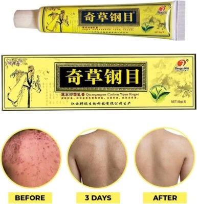 Cream Psoriasis Eczema Treatment Dermatitis Skin for Body Relief Natural - Image 1 of 3