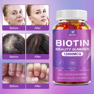 MENXI Vitamatic Biotin Gummies 12000 mcg for Stronger Hair Skin Nails 60 Vegan - Picture 1 of 9