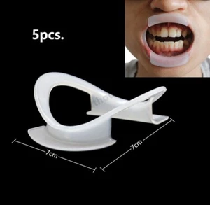 5pcs Dental Cheek Lip Retractor Mouth Opener O-Shape Intraoral Teeth Whitening - Picture 1 of 4