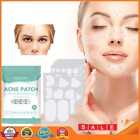 8pcs/pack Acne Removal Face Patch Natural Ingredient Acne Pimple Patch Skin Care