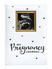 Pearhead My Pregnancy Journal Baby Keepsake Pregnancy Memory Book White and G...