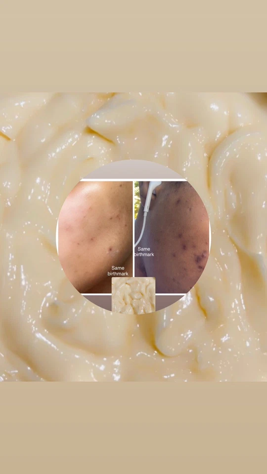 Dark Spot, Black Spot, Face Brightening, Pimples, Age Spots Rice & Egg Yolk FC. - Image 1 of 4