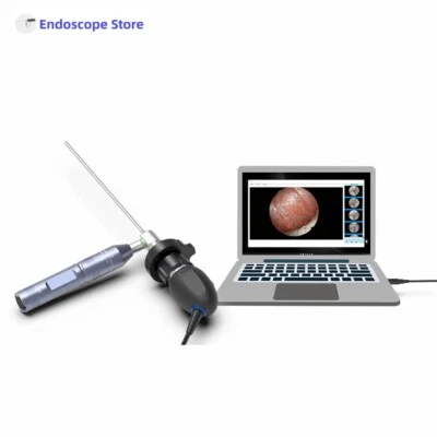 HD 1080P 60FPS USB Endoscope Camera Examination Surgery ENT Veterinary Clinic - Image 1 of 4