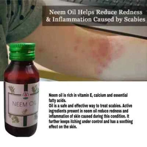 2x Anti Scabies Kills Scabies Mites And Eggs Complete Eradication Oil - Picture 1 of 4